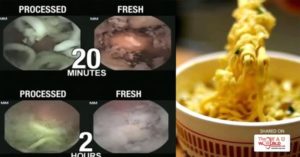 Mengejutkan, Begini Proses Pencernaan Mie Instan dalam Perut Manusia