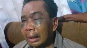 Sarpan Disiksa dan Dipaksa Akui Pembunuhan, 6 Polisi Diperiksa Propam Polda Sumut