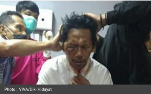 Imam Masjid Terluka Parah Dianiaya OTK