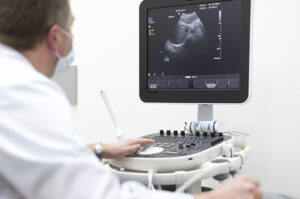 Alasan Pentingnya USG bagi Ibu Hamil dan Janin