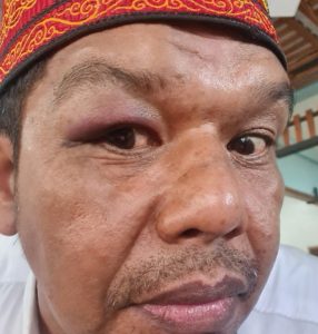 Insiden Pemukulan Pegawai Kesbangpol Bireuen Berakhir Damai