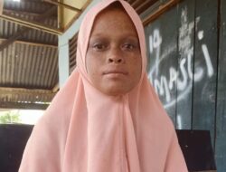 Penyakit Tambah Parah, Gadis asal Bireuen ini Butuh Biaya Berobat