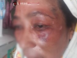 Perempuan Paruh Baya di Bireuen Mengaku Dibogem oleh Oknum Keuchiek