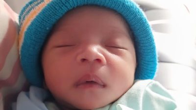 Maulida Sari, Bayi Tanpa Anus Butuh Uluran Tangan Dermawan   